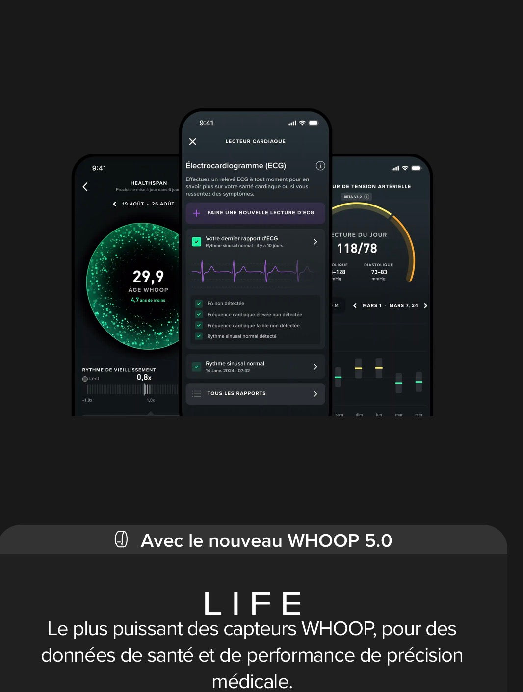 Whoop Life 5.0 MG Sensor